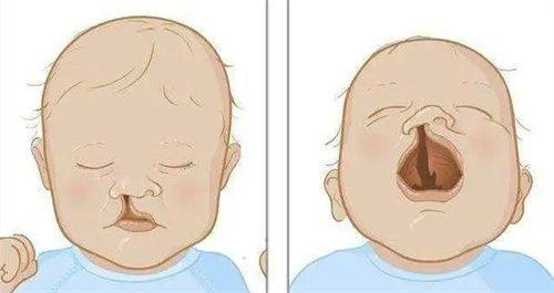 三、吸脂10斤的体重变化真相