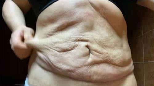 不同阶段的针对性修复方案