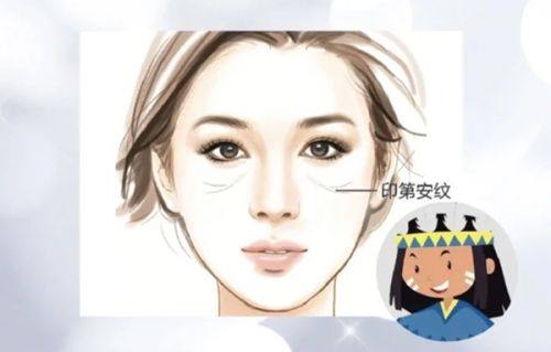 二、熊猫针:改善色素疤与轻度增生疤的优选