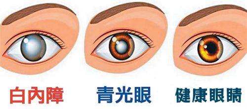 王心莲医生技术优势