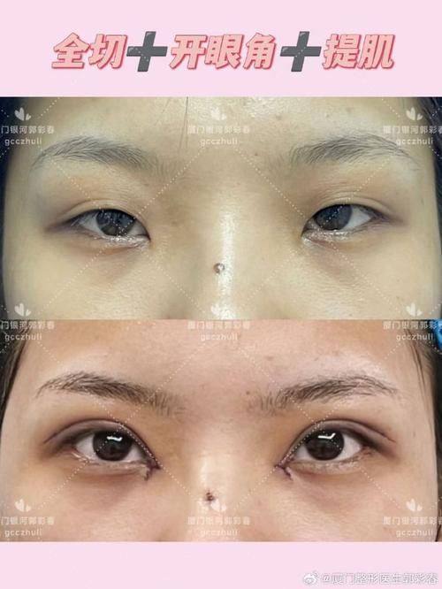 松滋亚美尔医疗美容门诊部价格表: