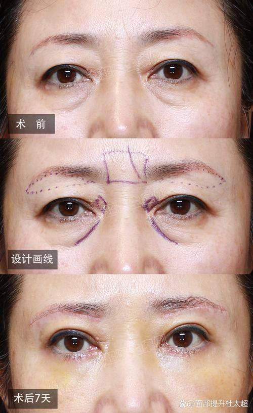 西安艺朵脂美人医疗美容医院地址电话及营业时间: