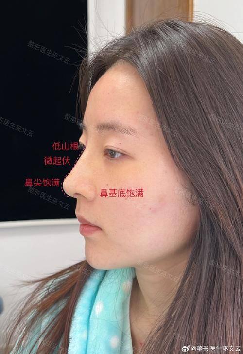 浙江温州致臻颐和整形口碑评价: