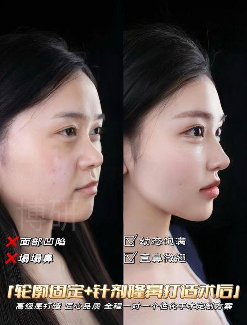 长沙蔓洛迦医疗整形擅长项目