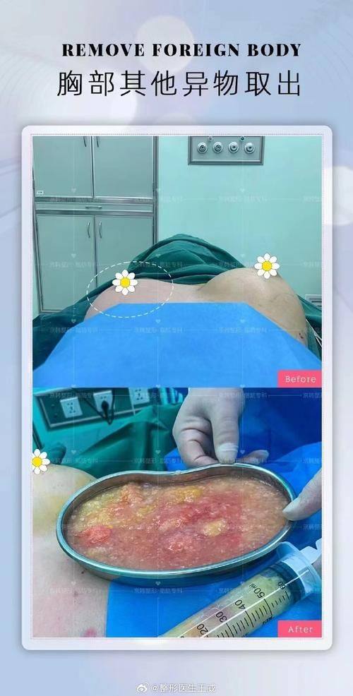 松滋亚美尔医疗美容门诊部擅长项目: