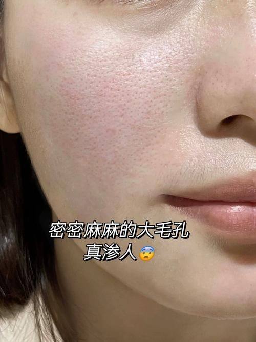 佛山天笙整形医院擅长项目: