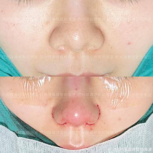 佛山天笙整形医院怎么样?