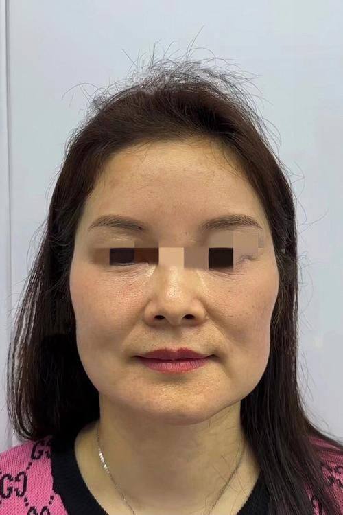 松滋亚美尔医疗美容门诊部预约挂号方式: