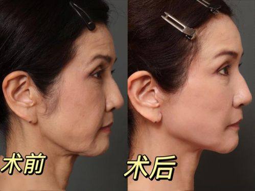 松滋亚美尔医疗美容门诊部口碑评价: