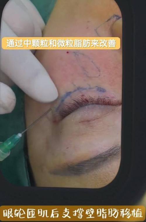 惠州善泉医疗美容门诊部口碑评价: