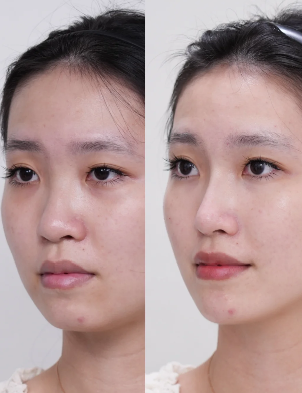 惠州善泉医疗美容门诊部地址电话及营业时间: