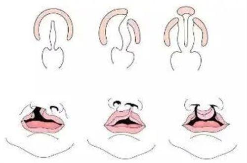 肇庆美创医疗美容门诊部预约挂号方式