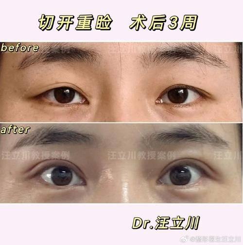 大连立美佳仁医疗美容诊所口碑评价：