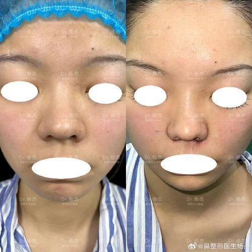 运城光子医疗美容门诊部地址电话及营业时间：