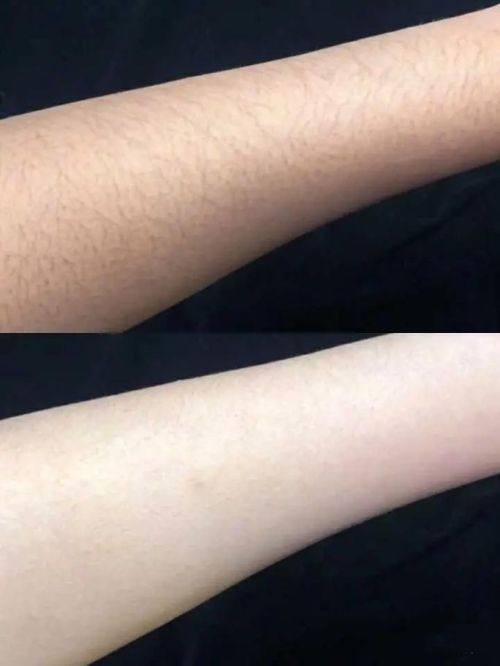 运城光子医疗美容门诊部擅长项目：