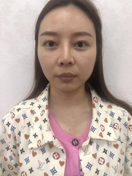 深圳市第二人民医院整形烧伤科口碑评价：