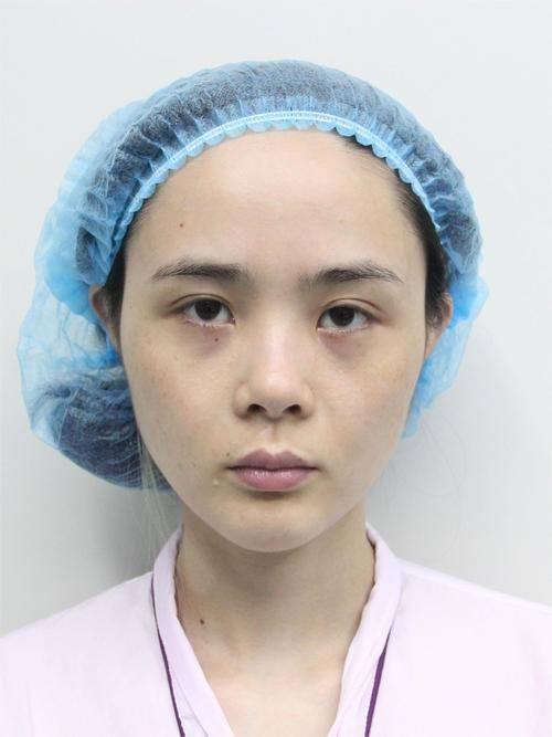 深圳市第二人民医院整形烧伤科价格表：