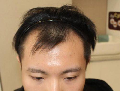 赣州依韩医疗美容门诊部擅长项目：