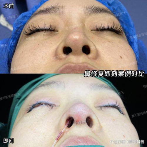 运城光子医疗美容门诊部预约挂号方式：