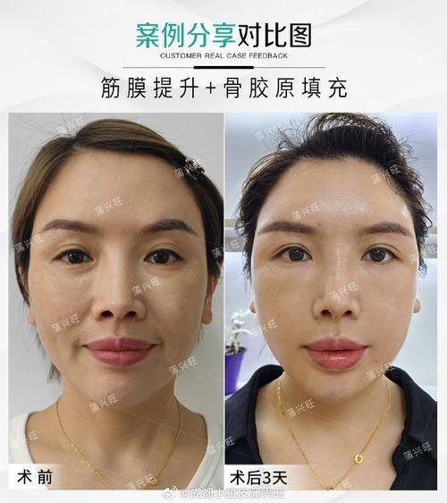 成都天使之翼整形医院医生名单及擅长领域