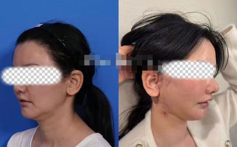 成都天使之翼整形医院地址电话及营业时间