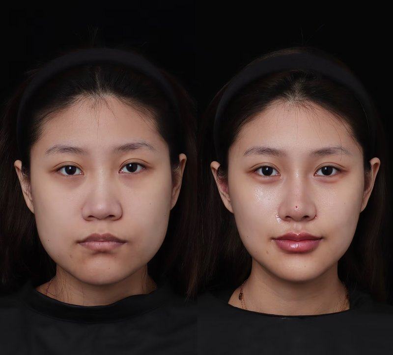 赣州依韩医疗美容门诊部价格表：