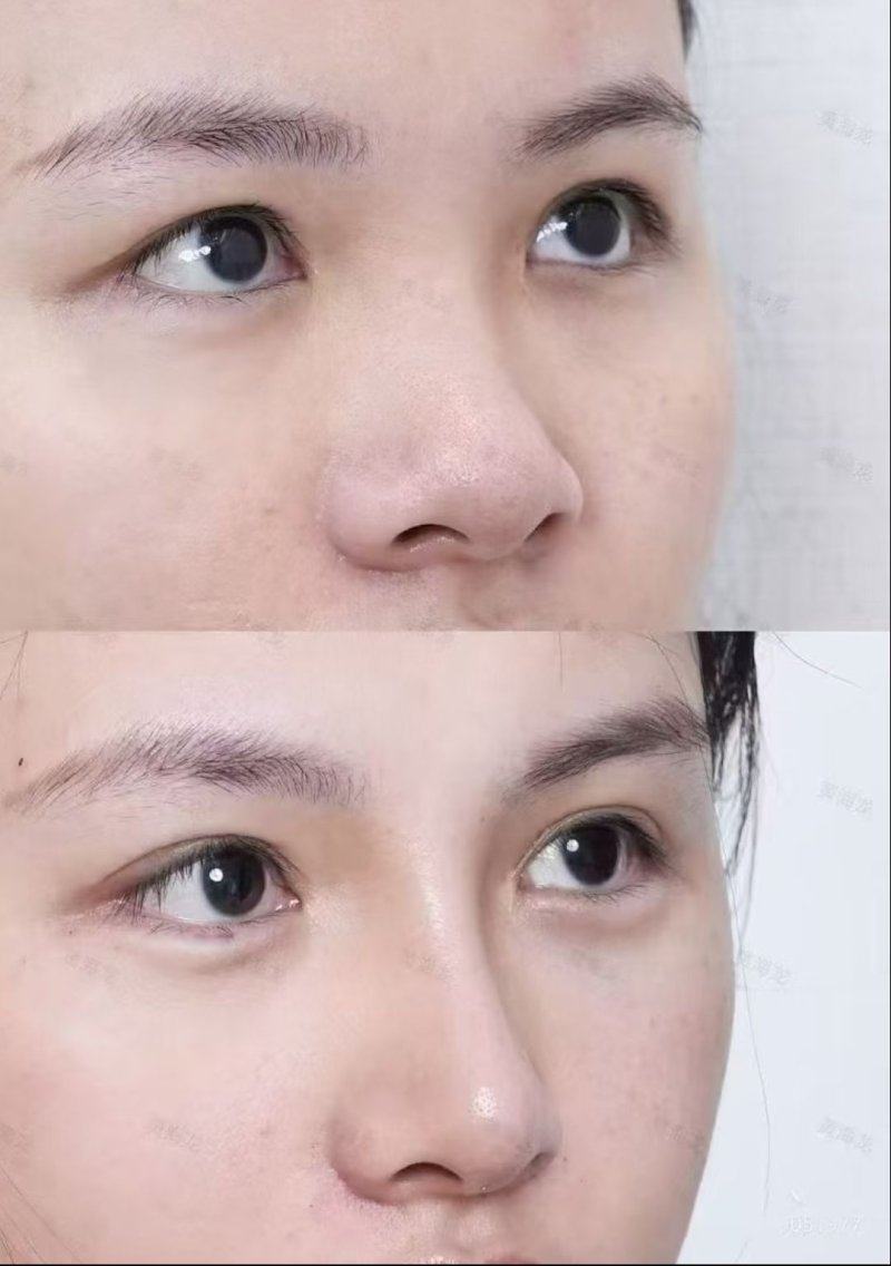 成都天使之翼整形医院擅长项目