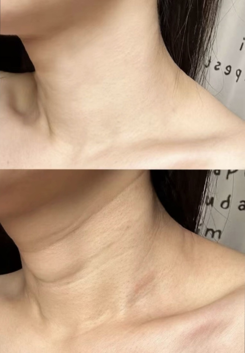 韩国美思科整形医院预约挂号方式