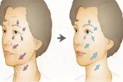 二、割双眼皮开眼角和不开眼角的区别