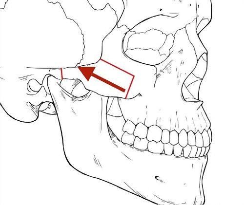 七、理线双眼皮与切开双眼皮的术式对比
