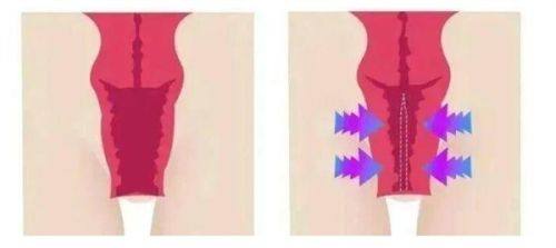 三、淡化陈旧性疤痕的科学护理建议