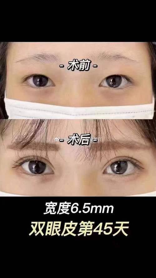 长沙俪姿整形医院预约挂号方式