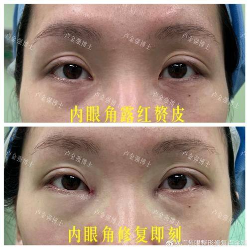 兰州市妇幼保健院整形美容外科擅长项目：