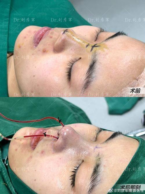 长沙协雅医学美容医院口碑评价：