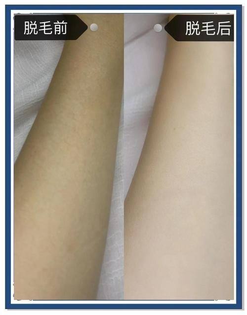 上海雍禾爱慕植发整形医院口碑评价：