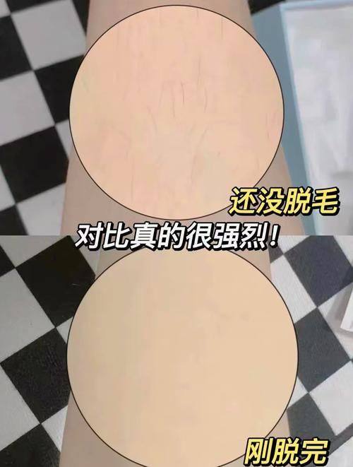 上海雍禾爱慕植发整形医院价格表：