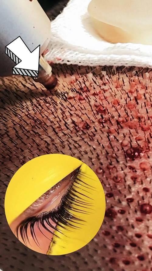 上海雍禾爱慕植发整形医院预约挂号方式：