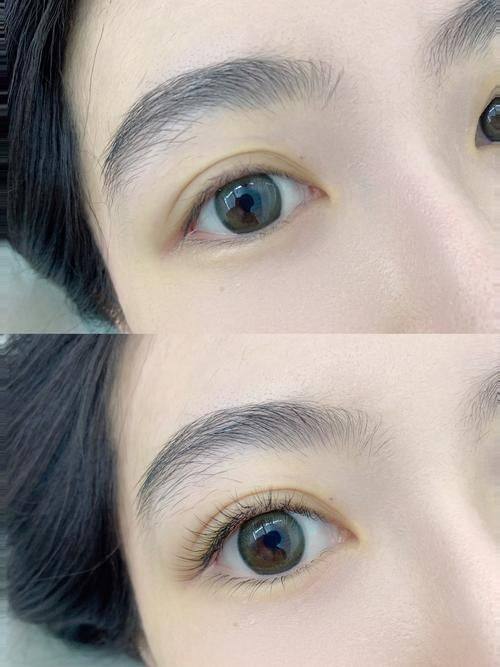 上海雍禾爱慕植发整形医院怎么样？