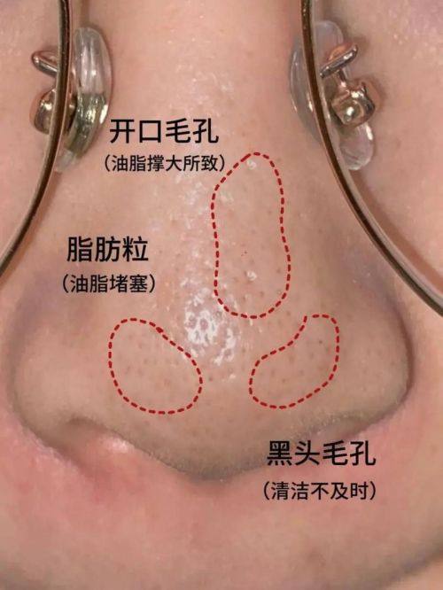 薛鲁杉医生擅长领域：