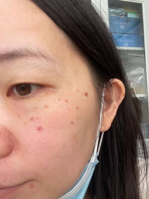 陈凌燕医生口碑评价：