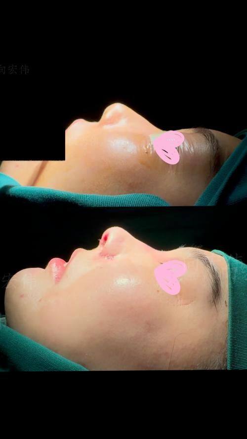 杭州卓俪荟医疗美容诊所价格表