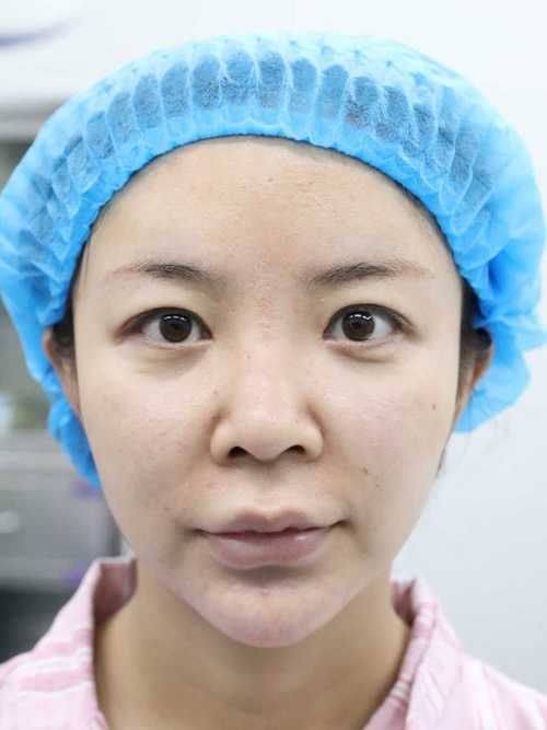 何方全医生口碑评价