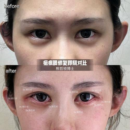 何方全医生怎么预约