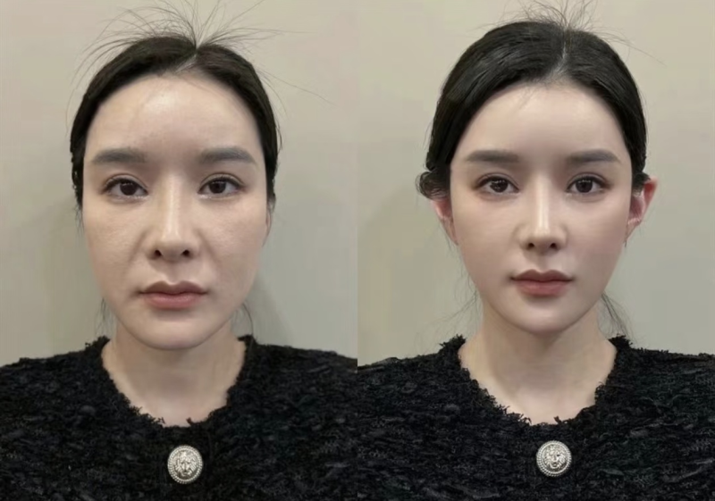 合肥星耀蓉颜整形医院擅长项目：