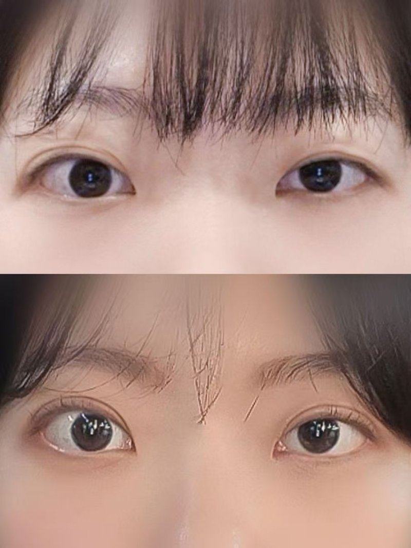 合肥星耀蓉颜整形医院口碑评价