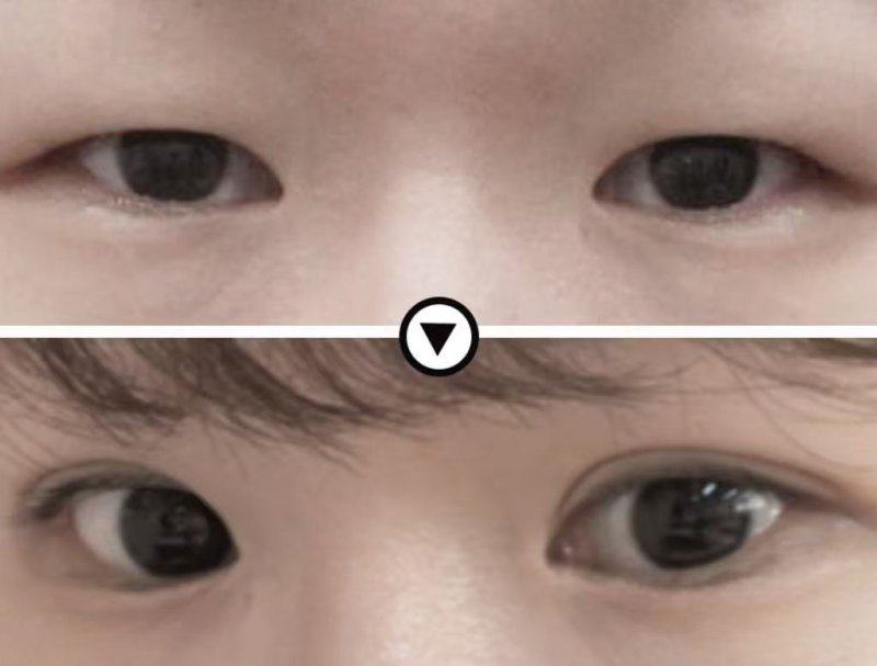 薛鲁杉医生技术优势：