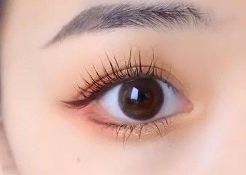 北京美泊医疗美容医院价格表：