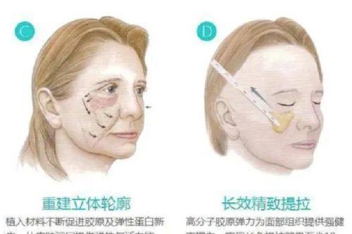 武会医生擅长领域：