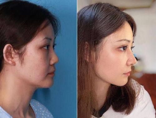 韩煜华医生技术优势