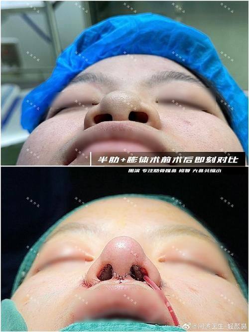 宁波美树诗悦美医疗美容诊所预约挂号方式